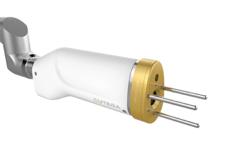 ピコフラクショナル