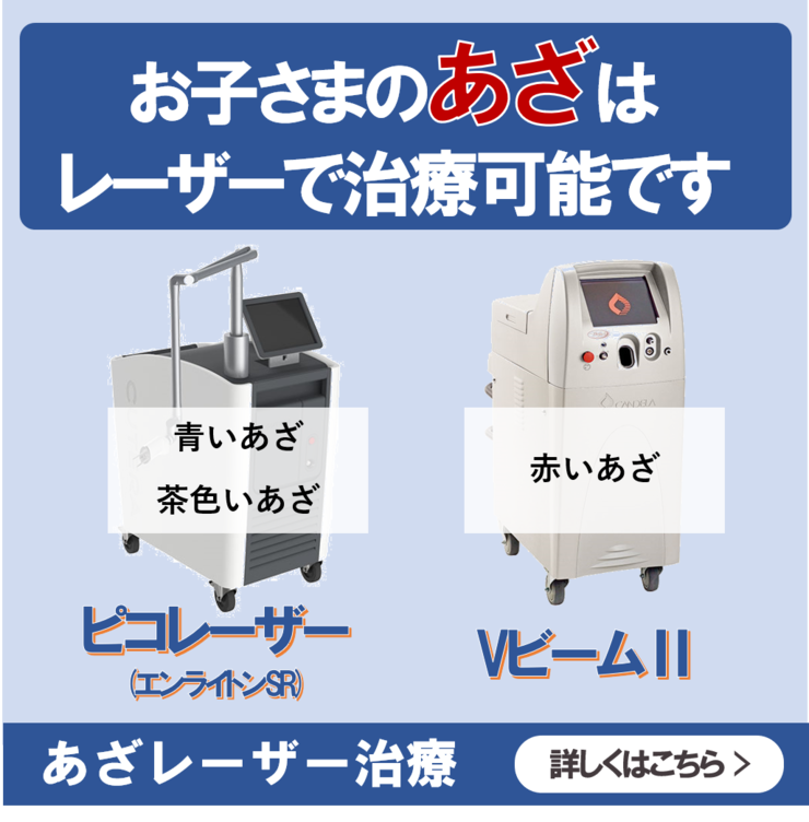 あざレーザー治療